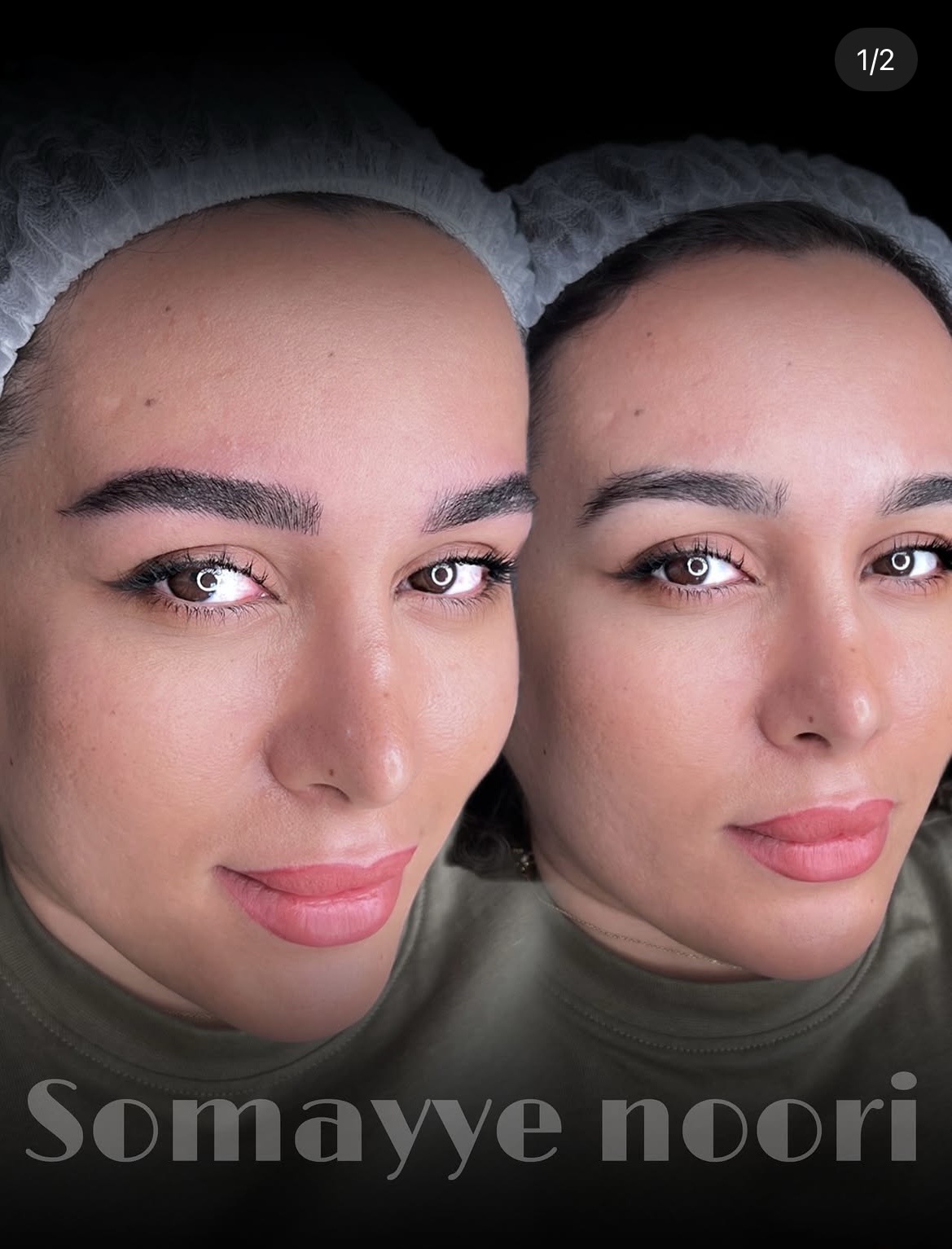 فیبروز و میکروبلیدینگ ابرو ستاره کریمی