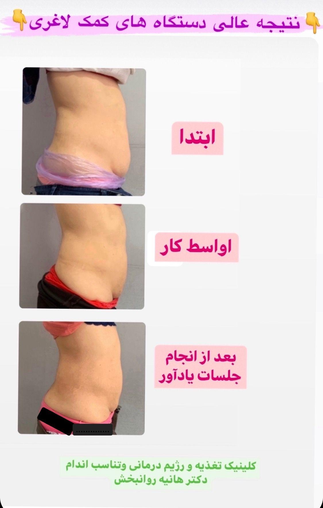 کلینیک تغذیه و رژیم درمانی و تناسب اندام (دکتر هانیه روانبخش)