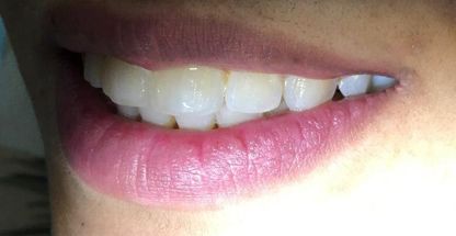 متخصص ارتودنسي-دندانپزشكي توانایان