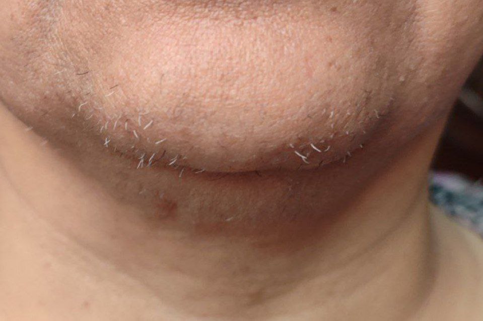 کلینیک الکترولیز