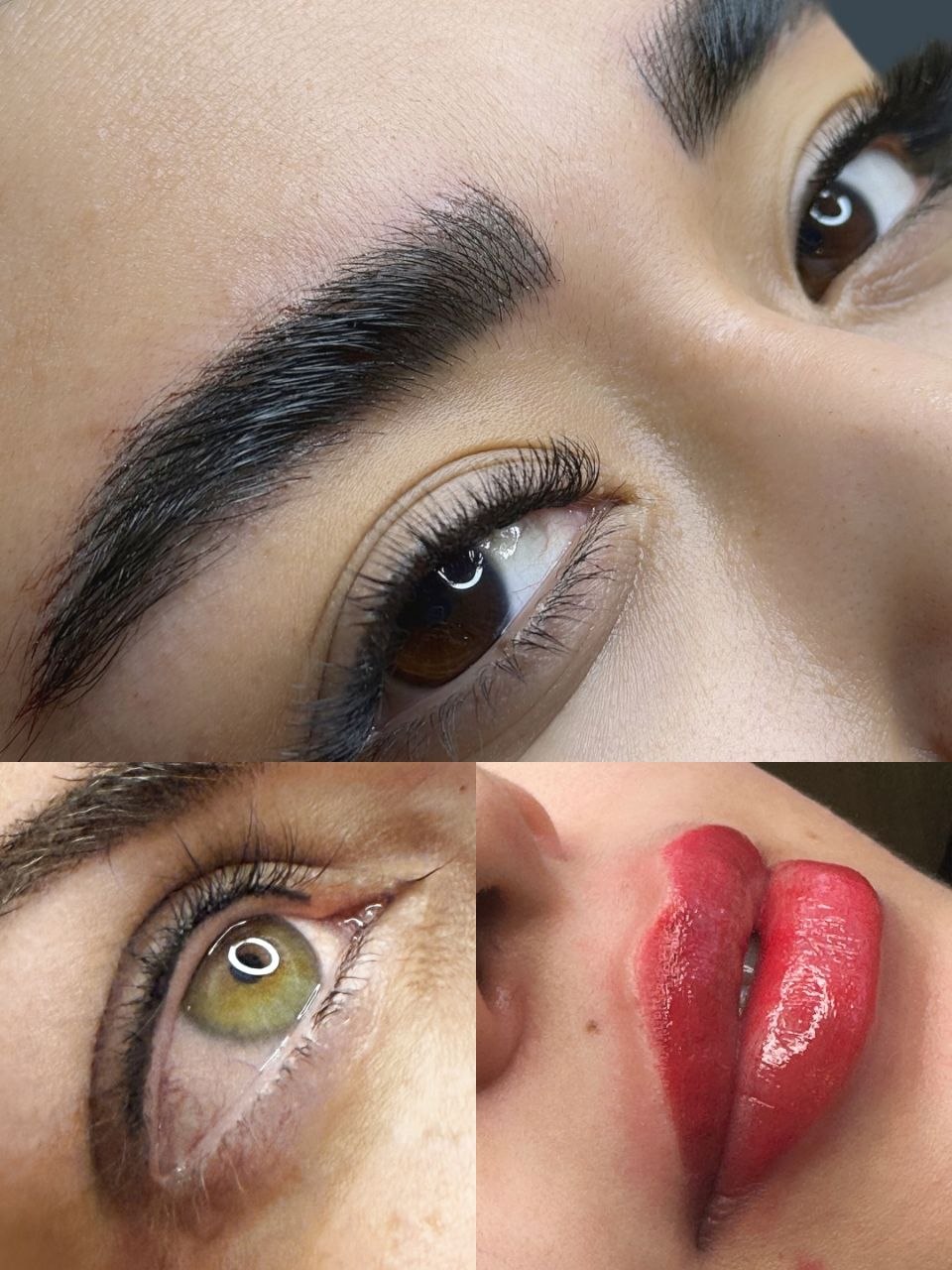 هدا ایزدی ؛ میکرو تخصصی صورت اصفهان