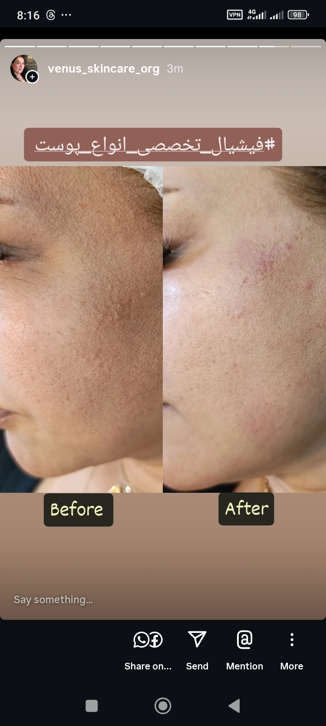 فیشال تخصصی و درمانی ونوس اسکینکر