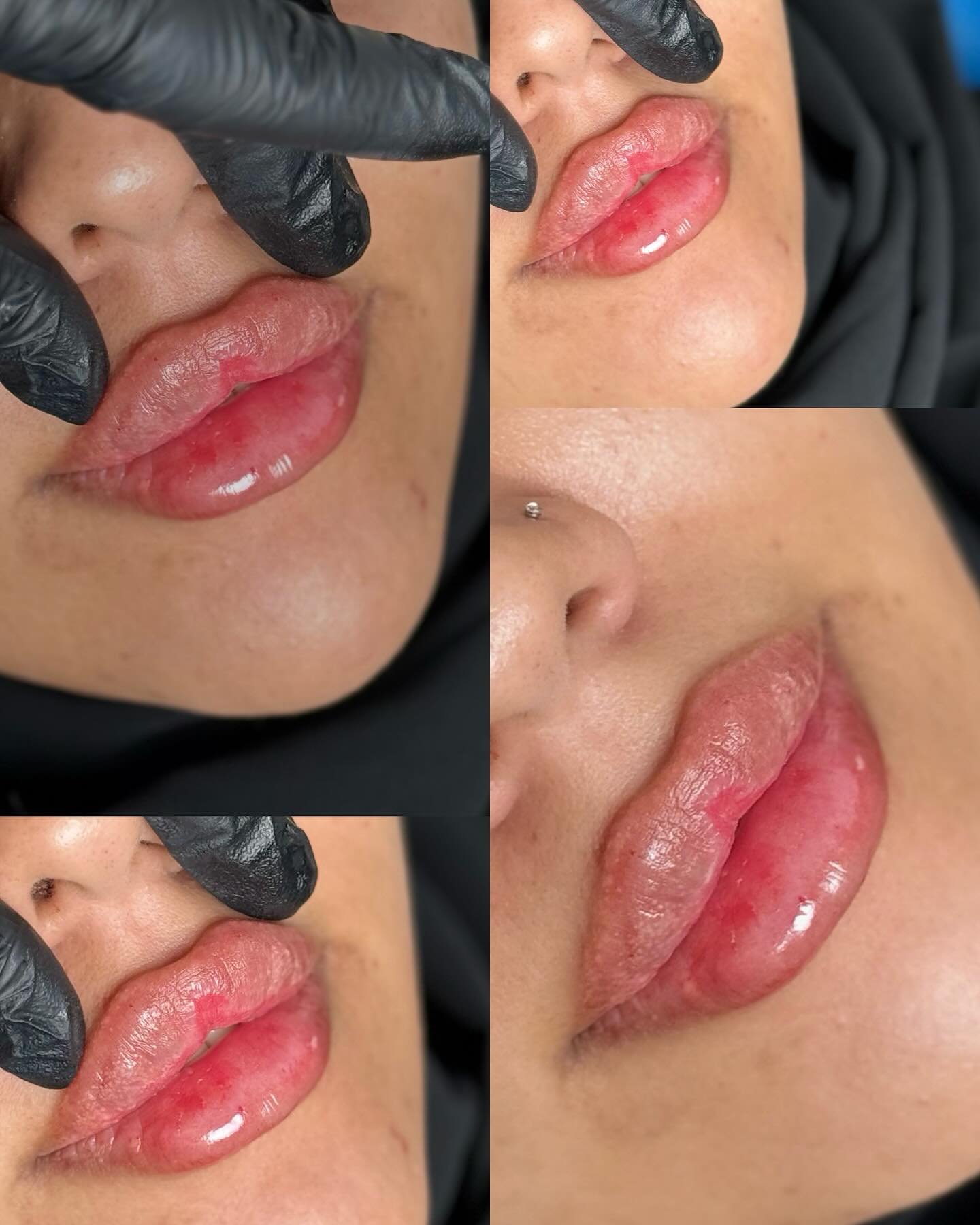 کلینیک پوست،زیبایی و لیزرماریسا