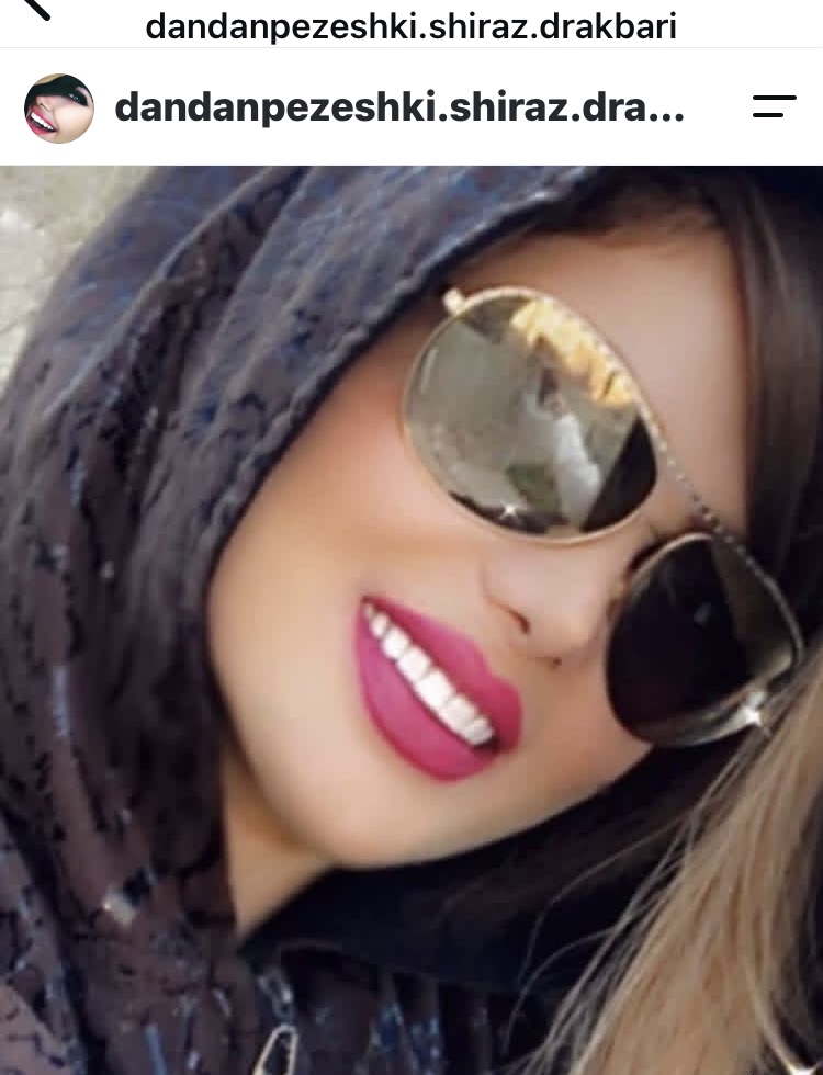 دکتر حسین اکبری دندانپزشک (زیبایی )