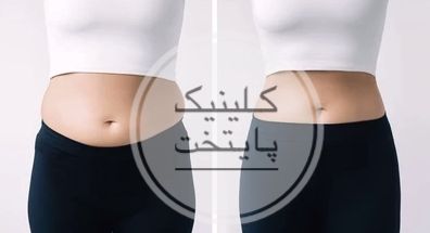 کلینیک لاغری و زیبایی پایتخت