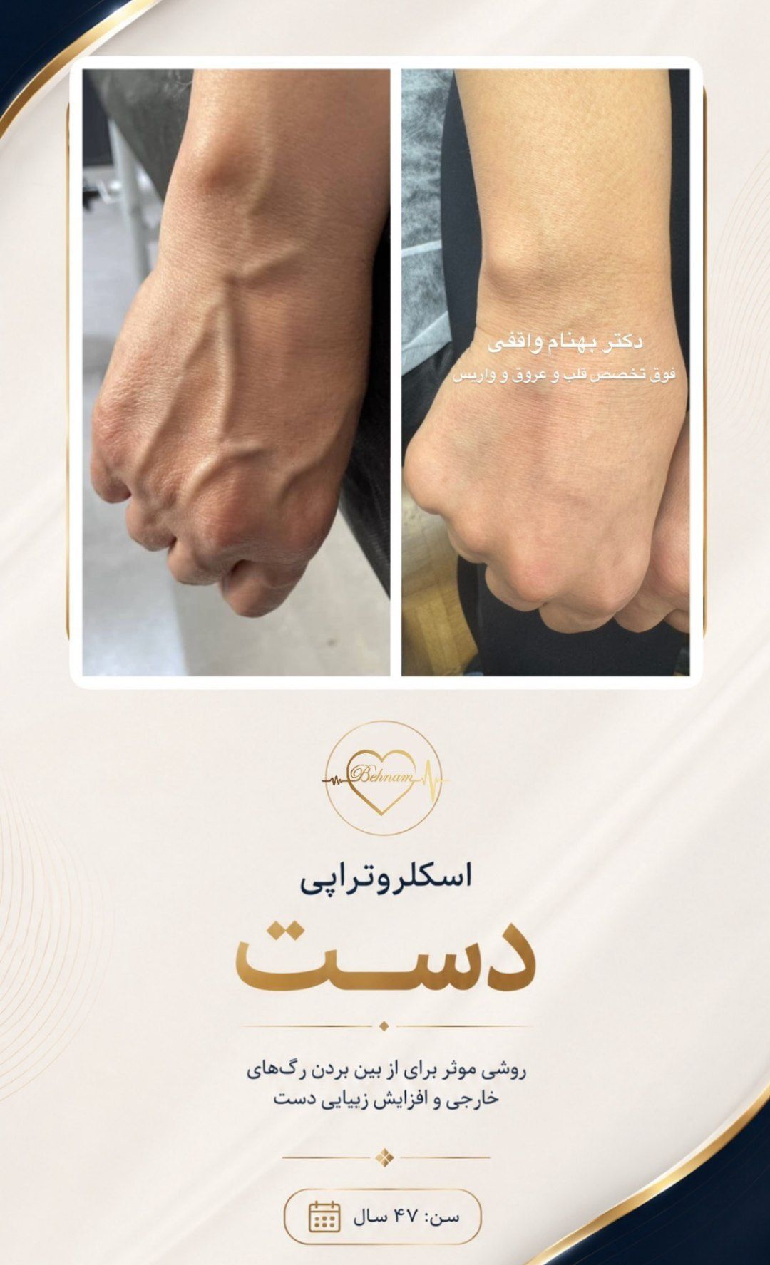 کلینیک تخصصی درمان واریس دکتر واقفی