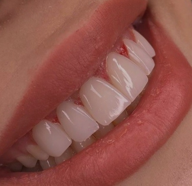 خانه کامپوزیت مروارید