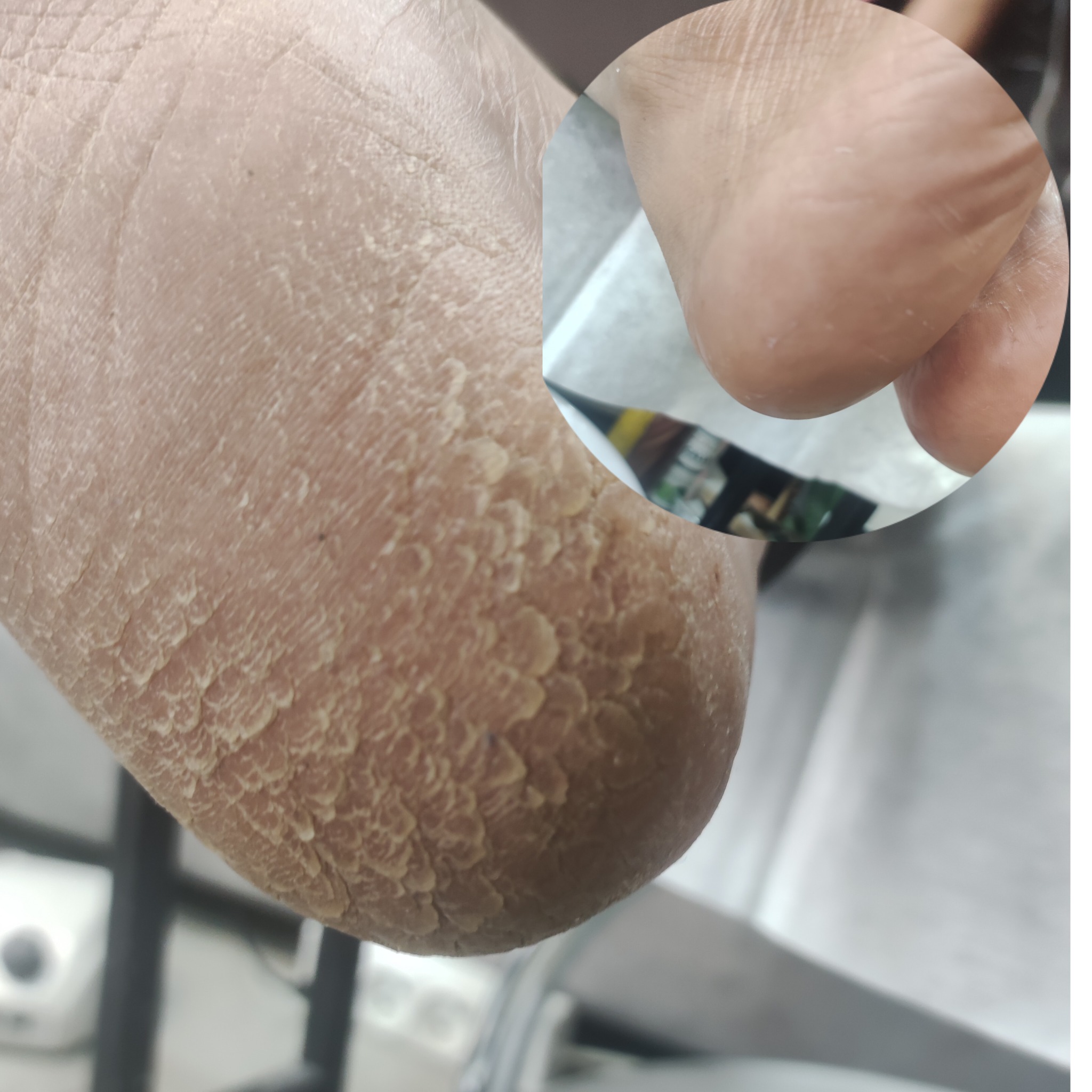 پدیکور فریده کریمی