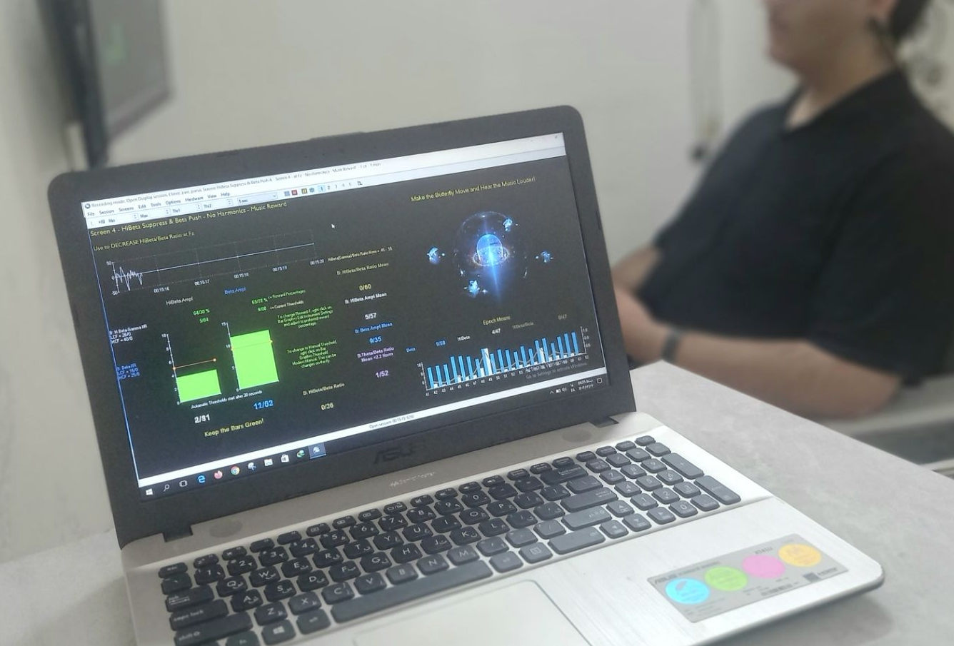 روانشناسی و نوروفیدبک