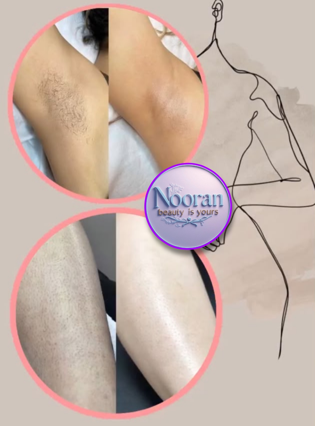 کلینیک زیبایی و مرکز لیزر نوران