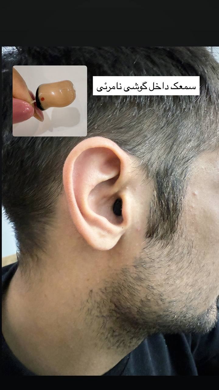 سمعک و شنوایی سنجی هما