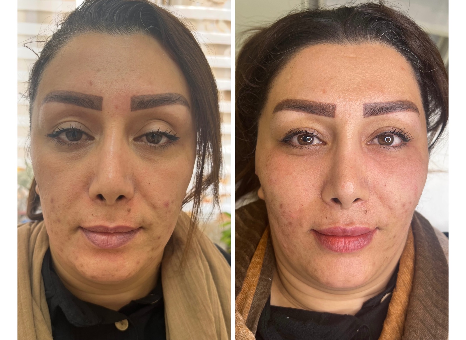 کلینیک زیبایی مهر دخت آتوسا
