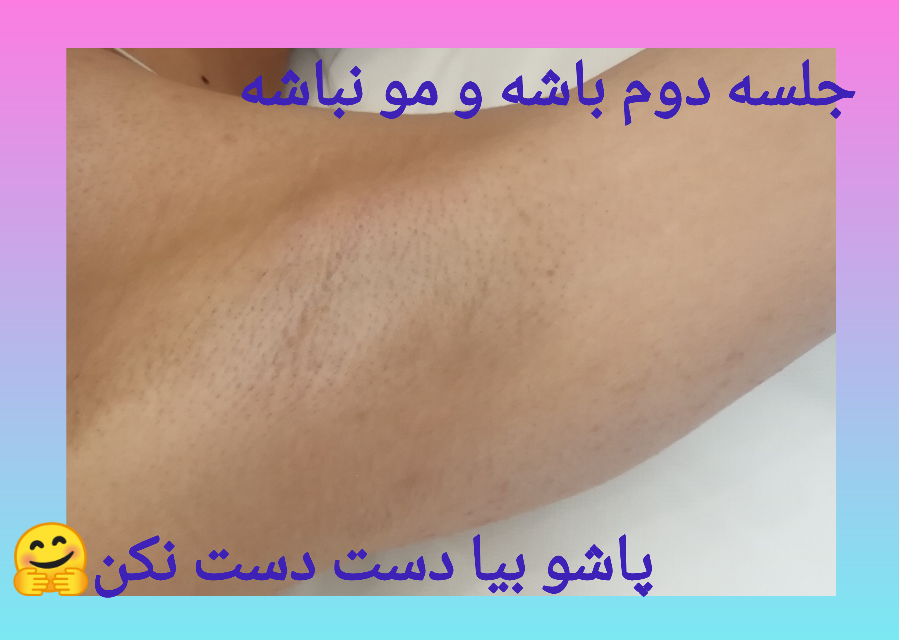 مرکز ریمو و لیزر آلما