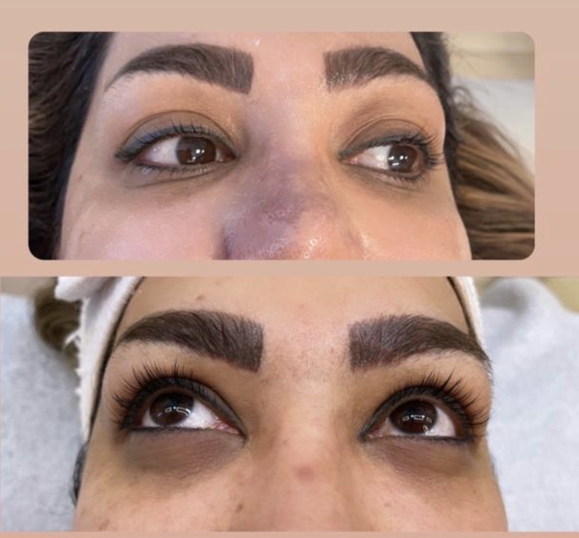 فیشیال و پاکسازی پوست تالگو فرانسه