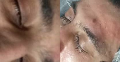 خدمات تخصصی فیشال  مرجان بیوتی