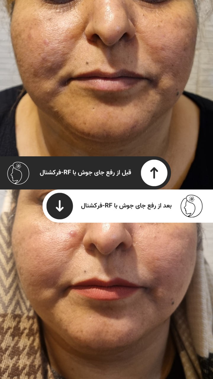 مرکز لیرز و جوانسازی پوست شهربانو