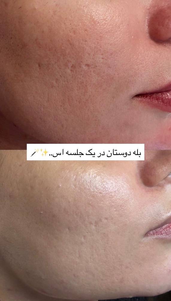 فیشیال تخصصی انواع پوست