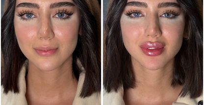 مجموعه لیزر و زیبایی کارنا(شاتی نداریم)