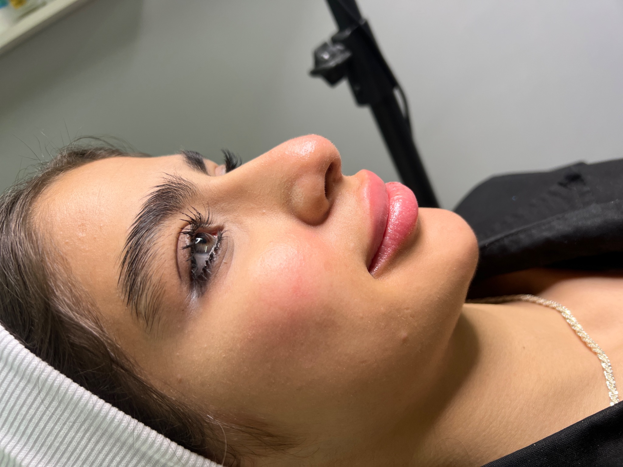 کلینیک لیزر ،ژل ،بوتاکس و لاغری ویتالایف