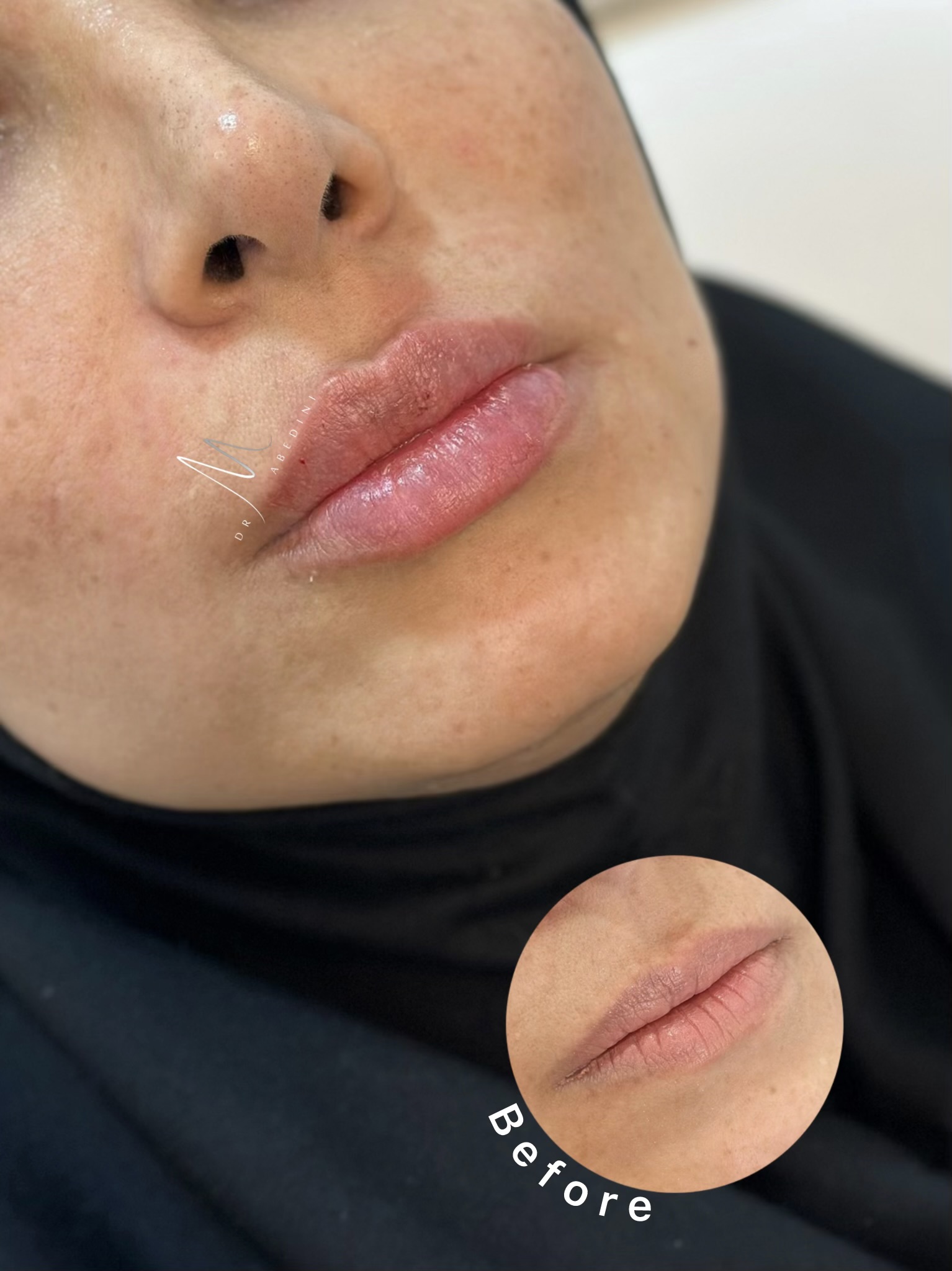 دکترمحیاعابدینی(تک متخصص پوست خانم ساوه)