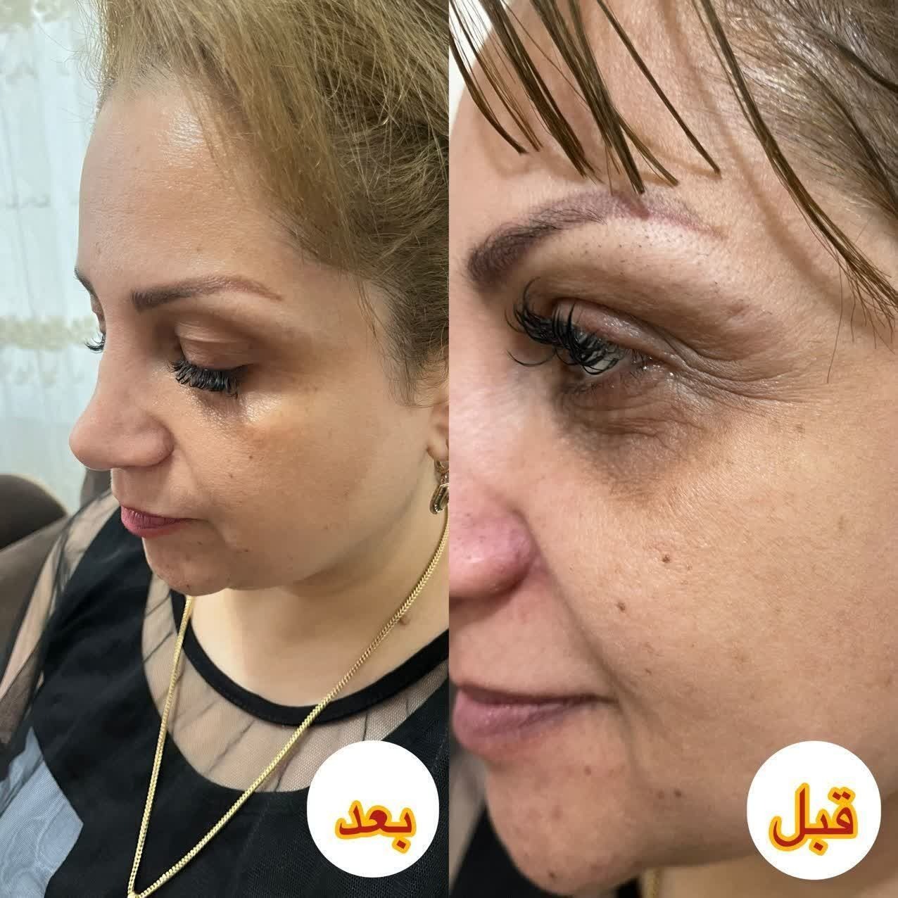 فشیال و مراقبت پوست و مو rahaskin