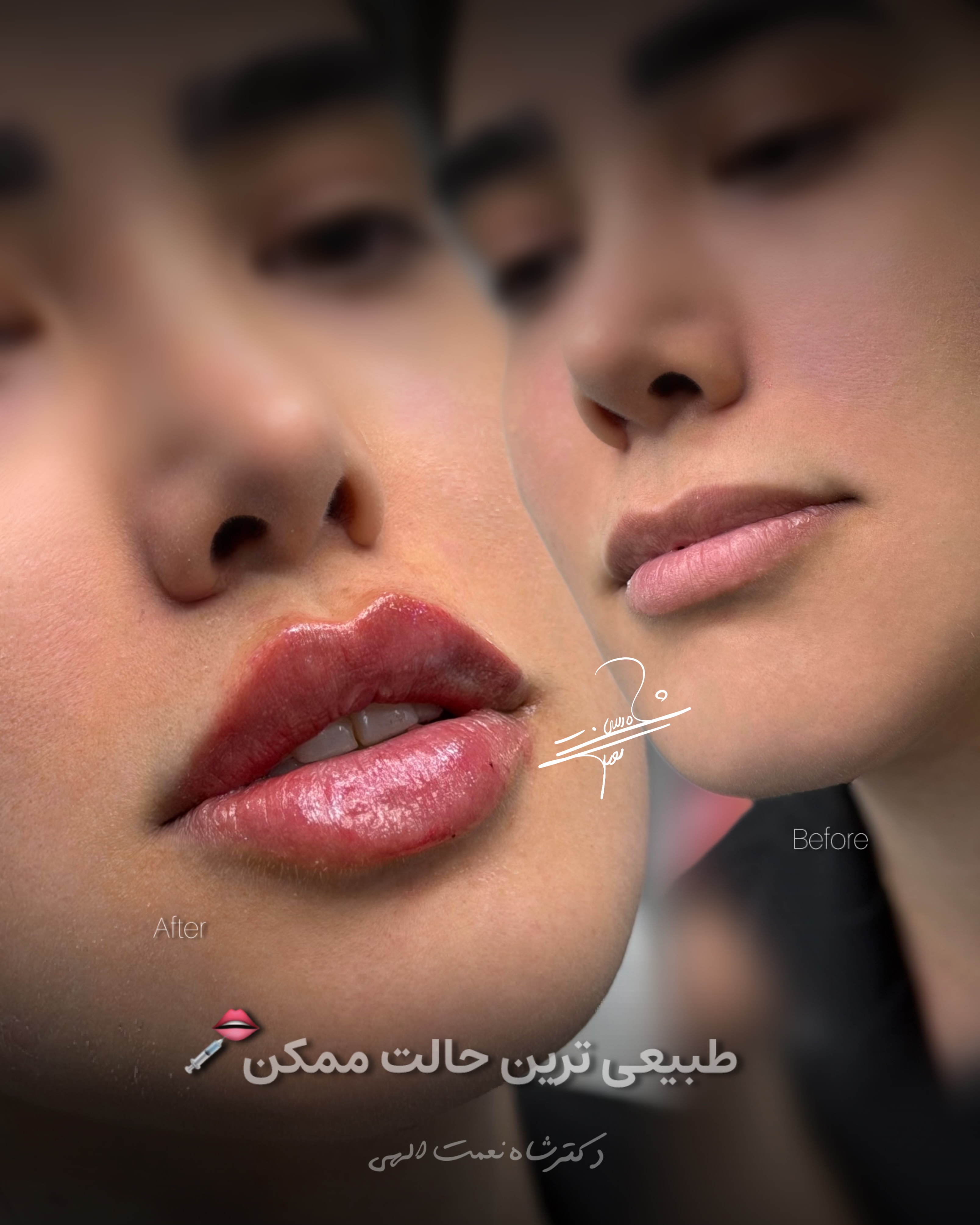 مرکز تخصصی لیزر باران