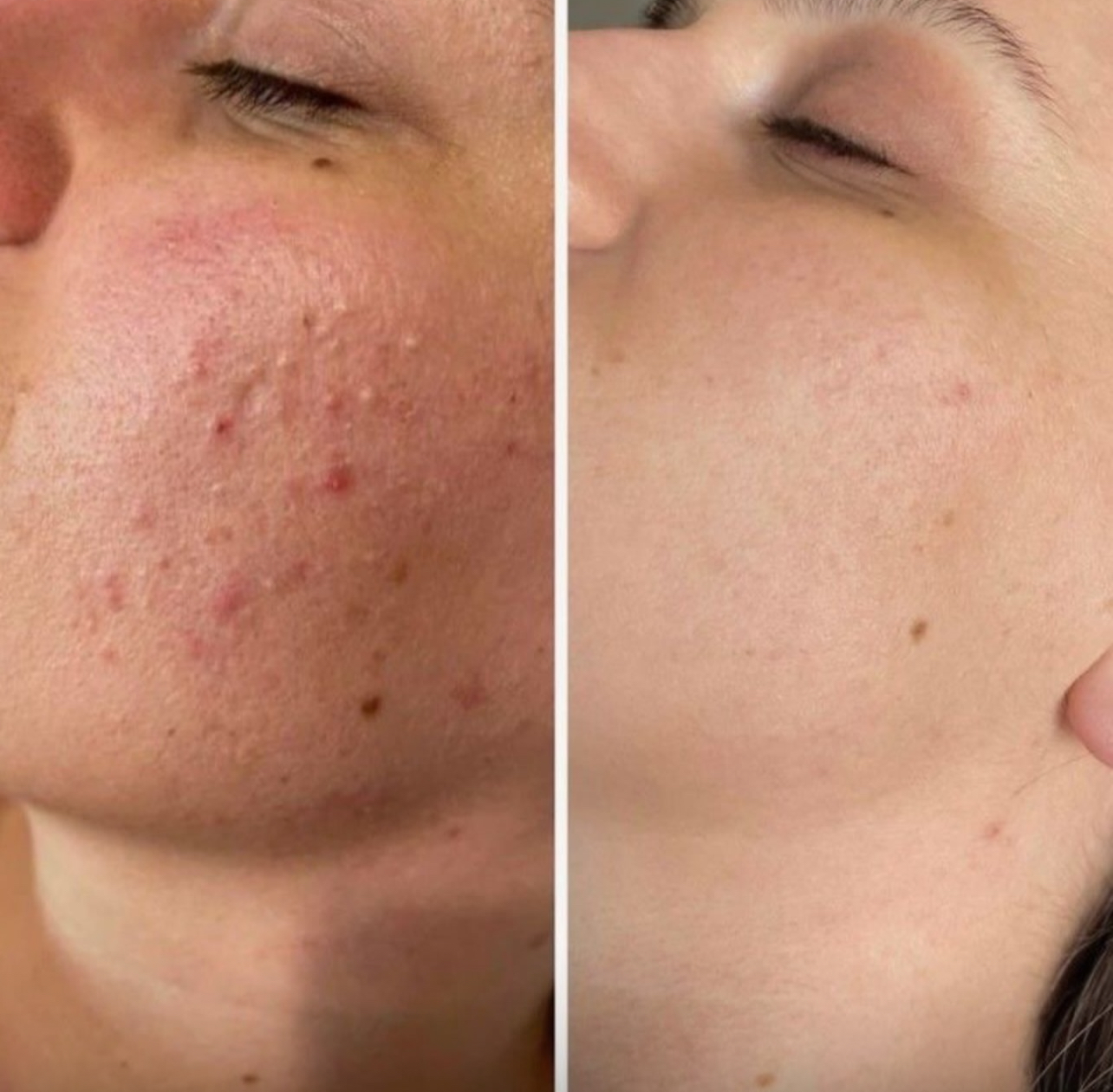 فیشال و اسکراپ اسکالپ عاطفه