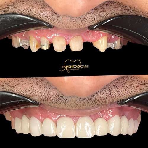 کلینیک دندانپزشکی دکتر مهرزاد زارع