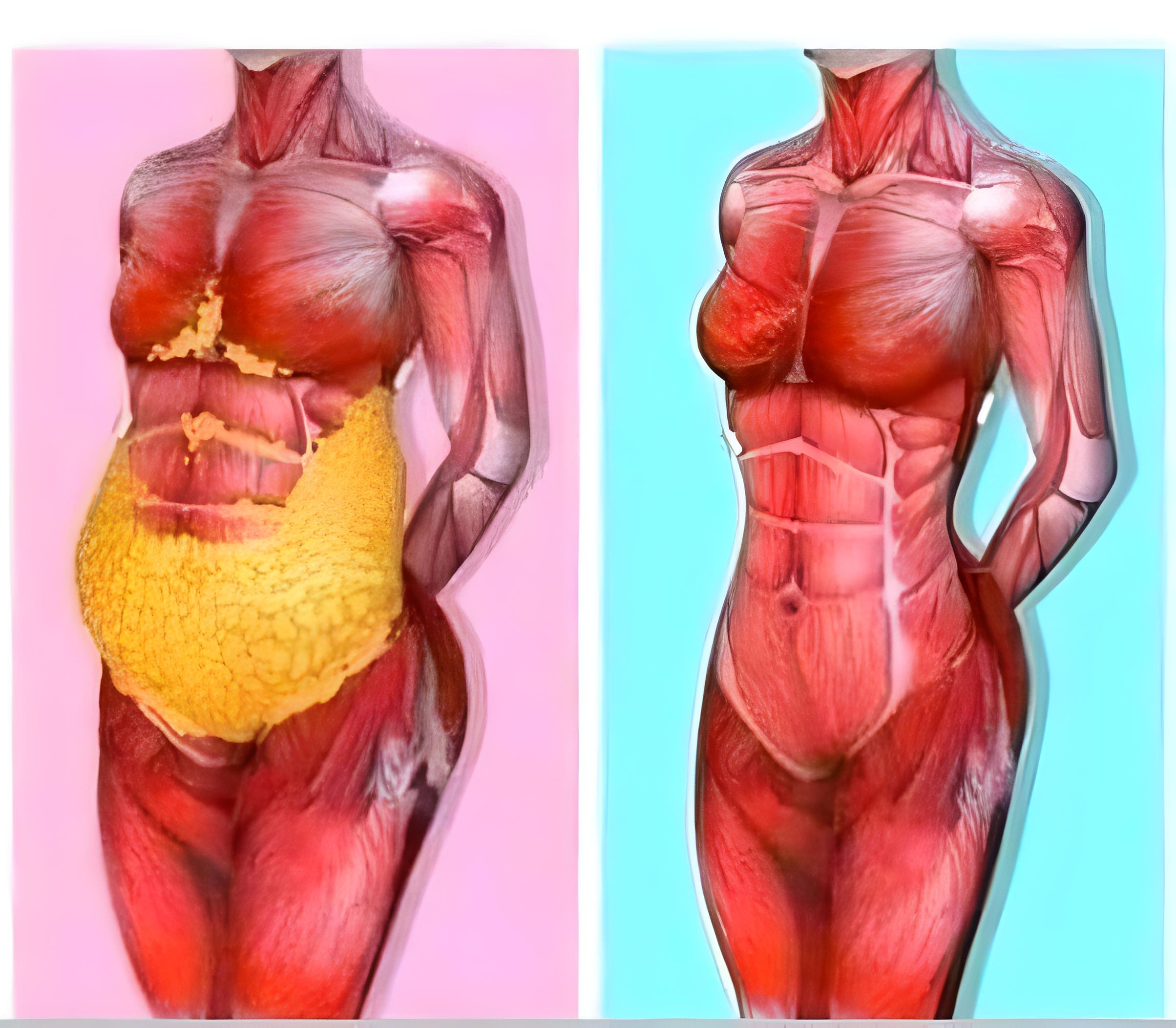 کلینیک لاغری Fit__body7