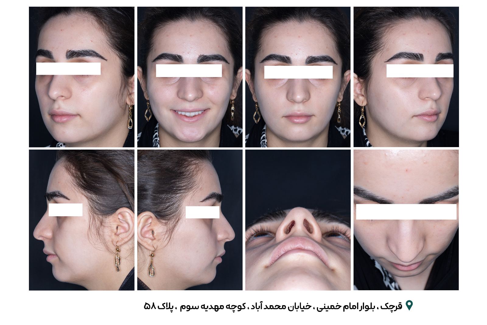 رادیولوژی و سونوگرافی بتا