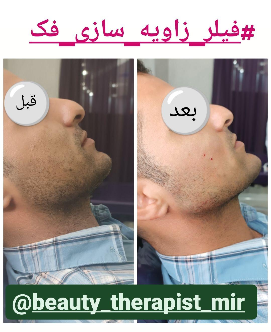 کیلینک آپادانا