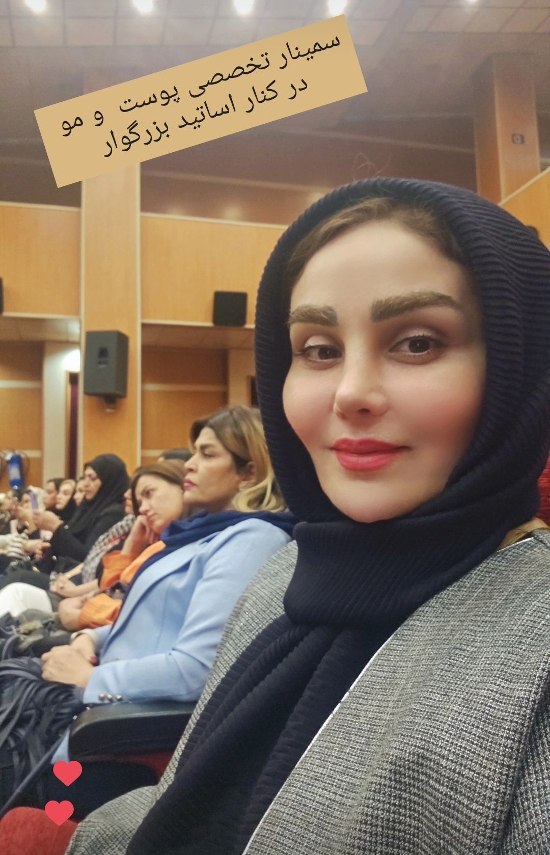 مریم درویشی میکرواسکالپ سر در اهواز