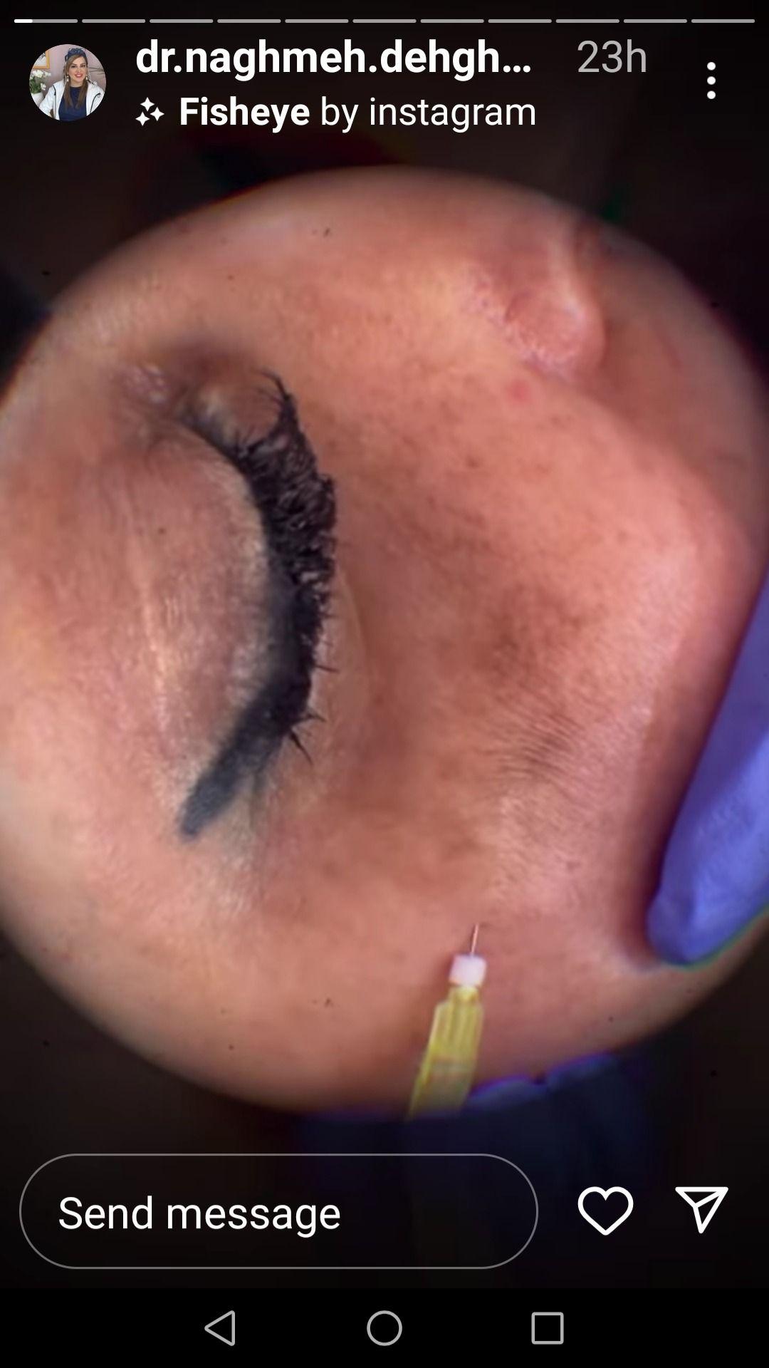 دکتر زیبایی بوتاکس دکتر شیرین امیر حسنی