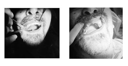 دندانپزشکی ایمپلنت دکتر علی اکبر مومنی