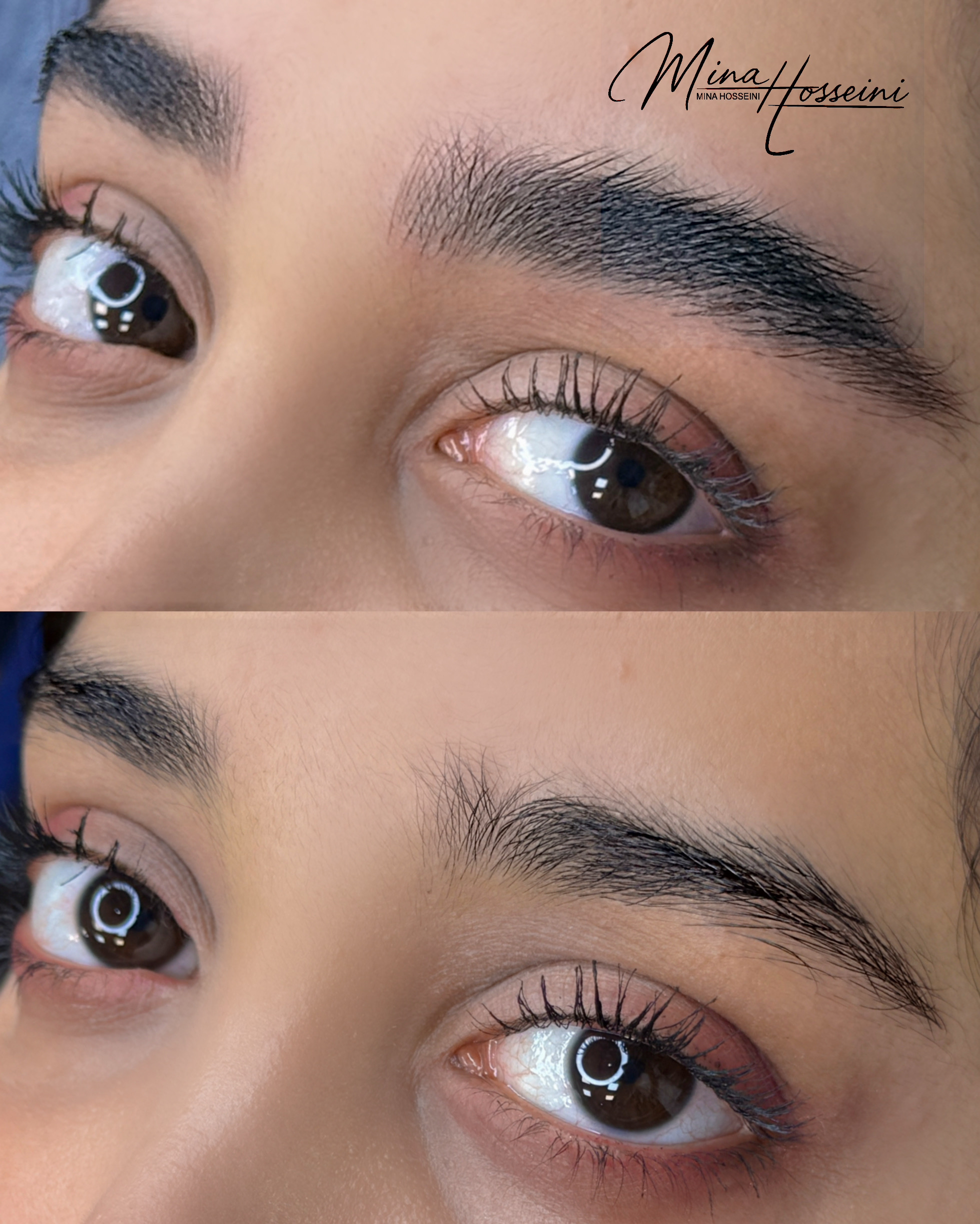 میکروبلیدینگ و شیدینگ مینا حسینی