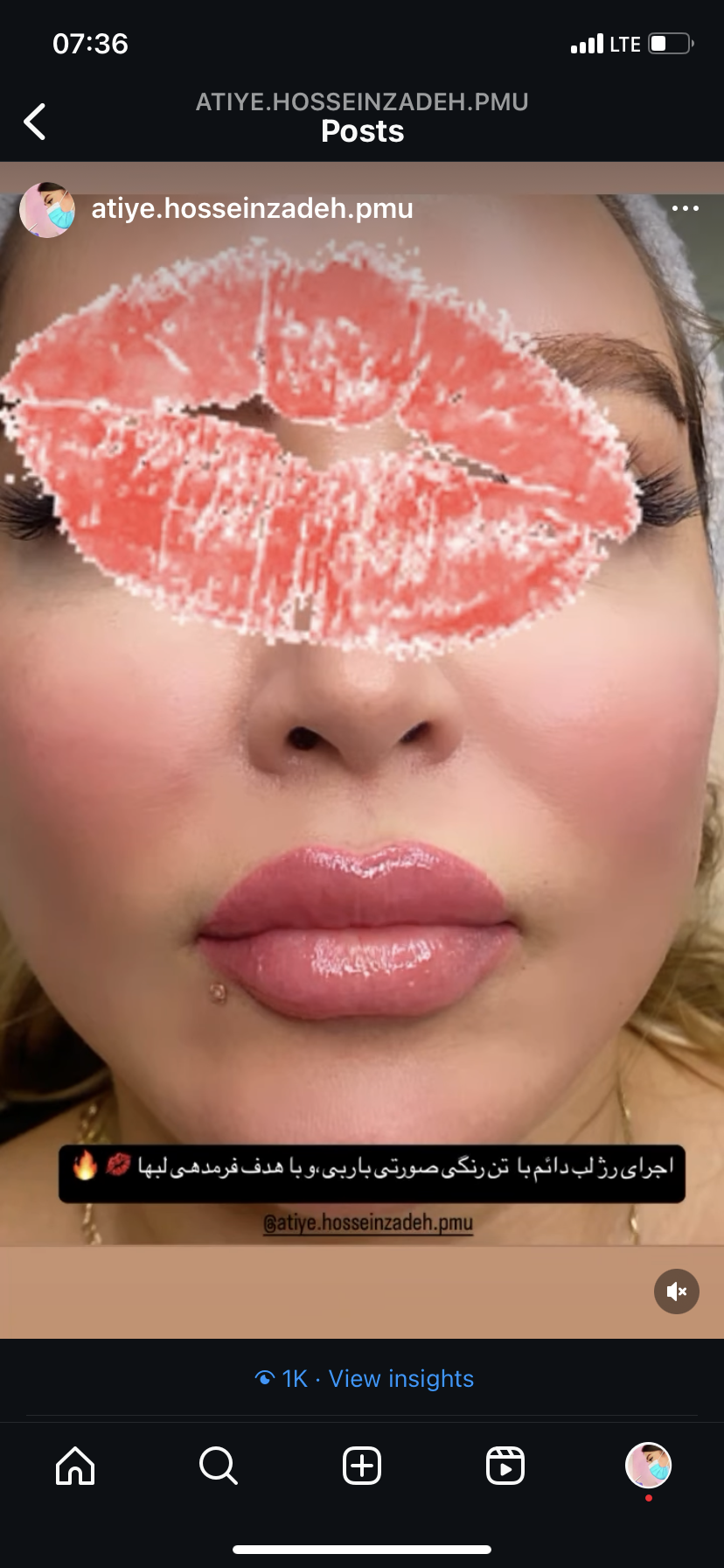 میکروکار حسین زاده