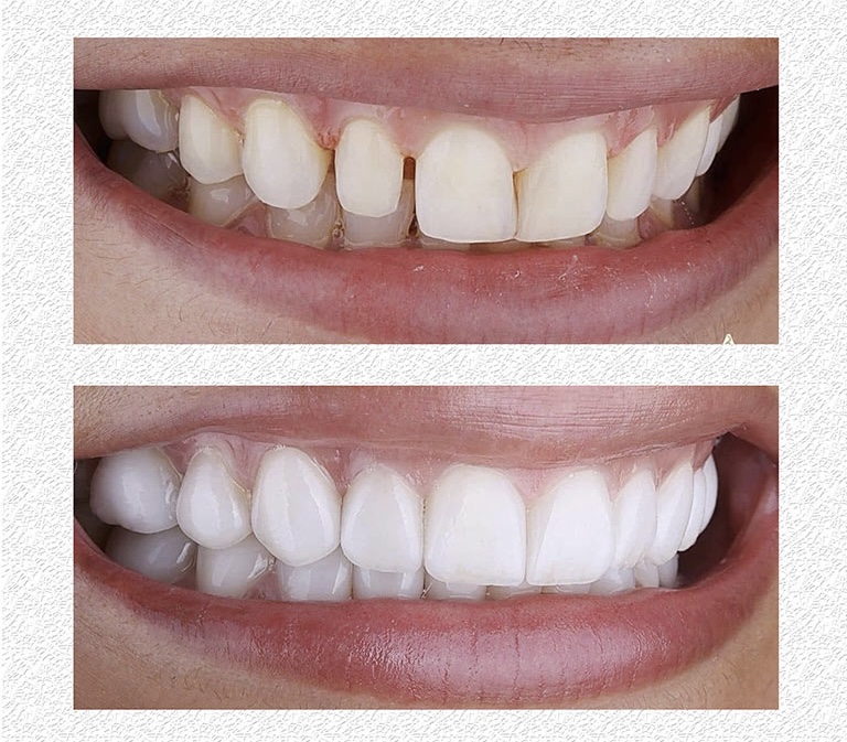 دندانپزشکی ابراهیمی