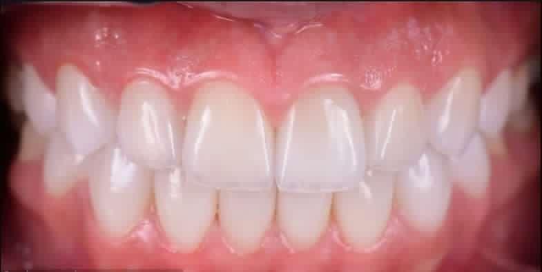 مطب دندانپزشکی درمان تخصصی ترمیمی و زیبایی پروتز وابت و متحرک