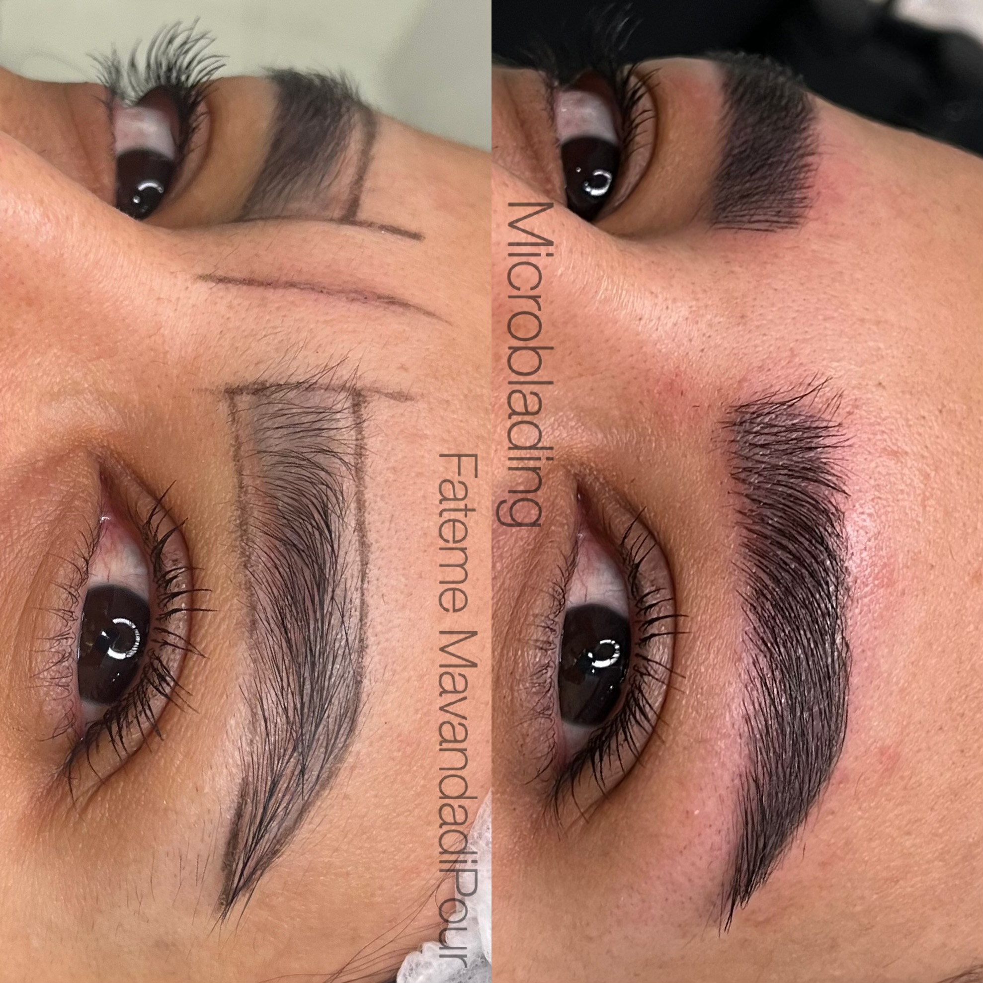 خدمات تخصصی ابرو ماوندادی پور