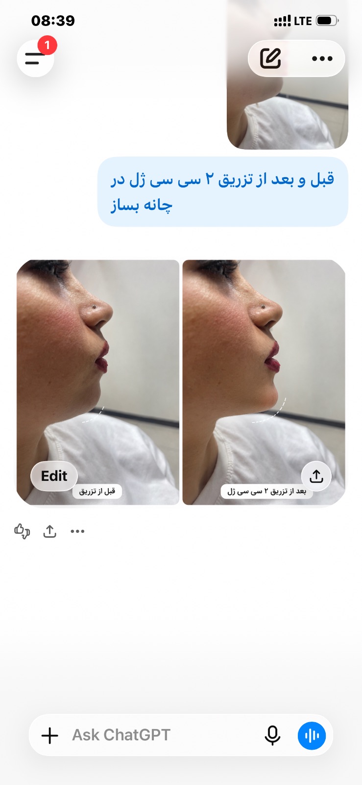 پوست مو زیبایی و لاغری دکتر درزی قائمشهر