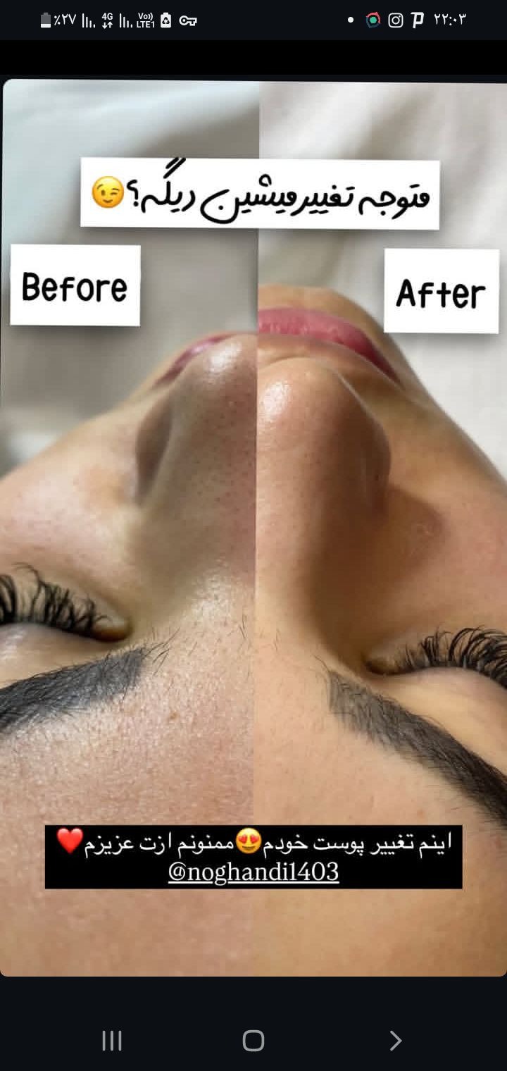 فشیال (پاکسازی روح و جسم)تو