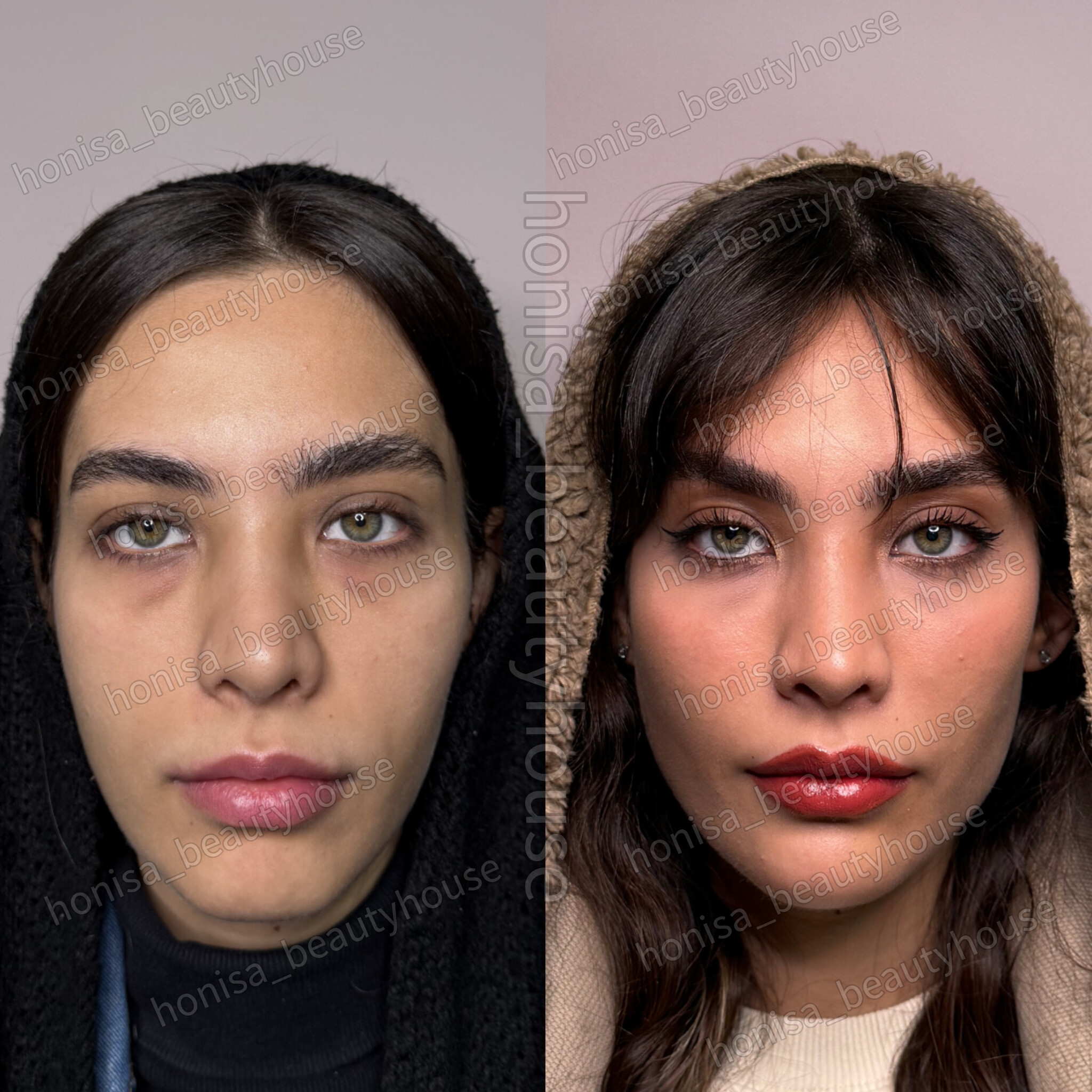 کلینیک زیبایی و مرکز لیزر هانیسا