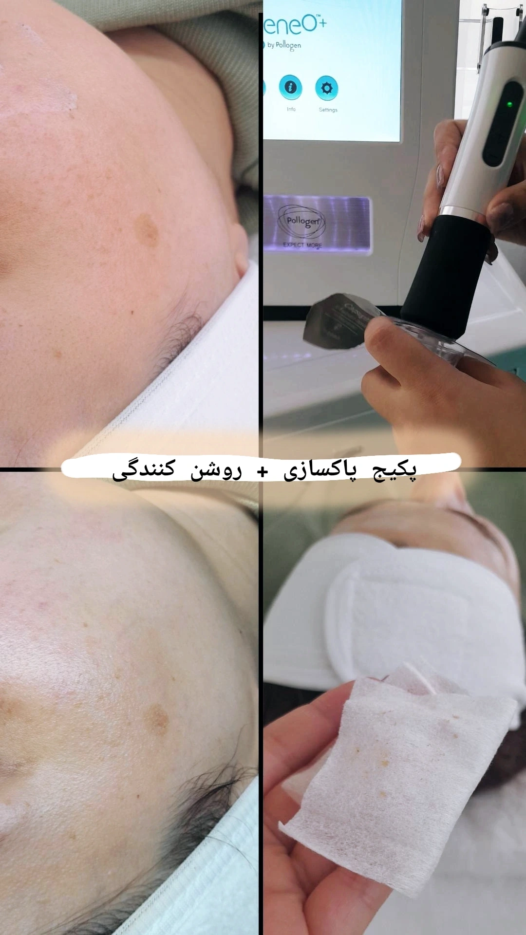 استودیو پوست هلیا فیشیال و پاکسازی تخصصی