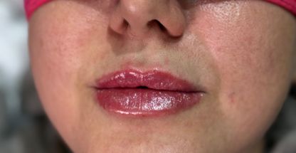 مطب پوست و مو  دکتر شعله زکی خانی