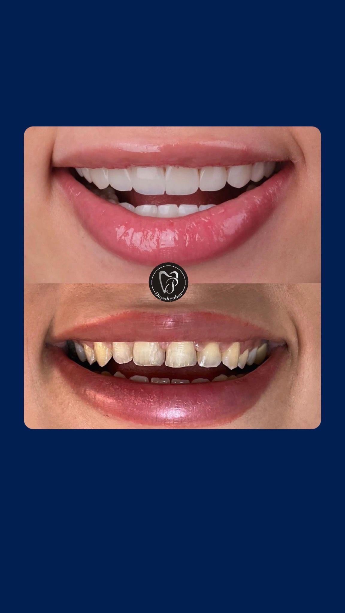 دندانپزشكي زيبايي،ايمپلنت و غيره