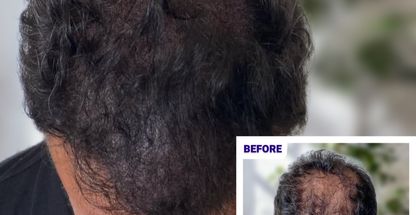 کلینیک تخصصی نوین اسکالپ