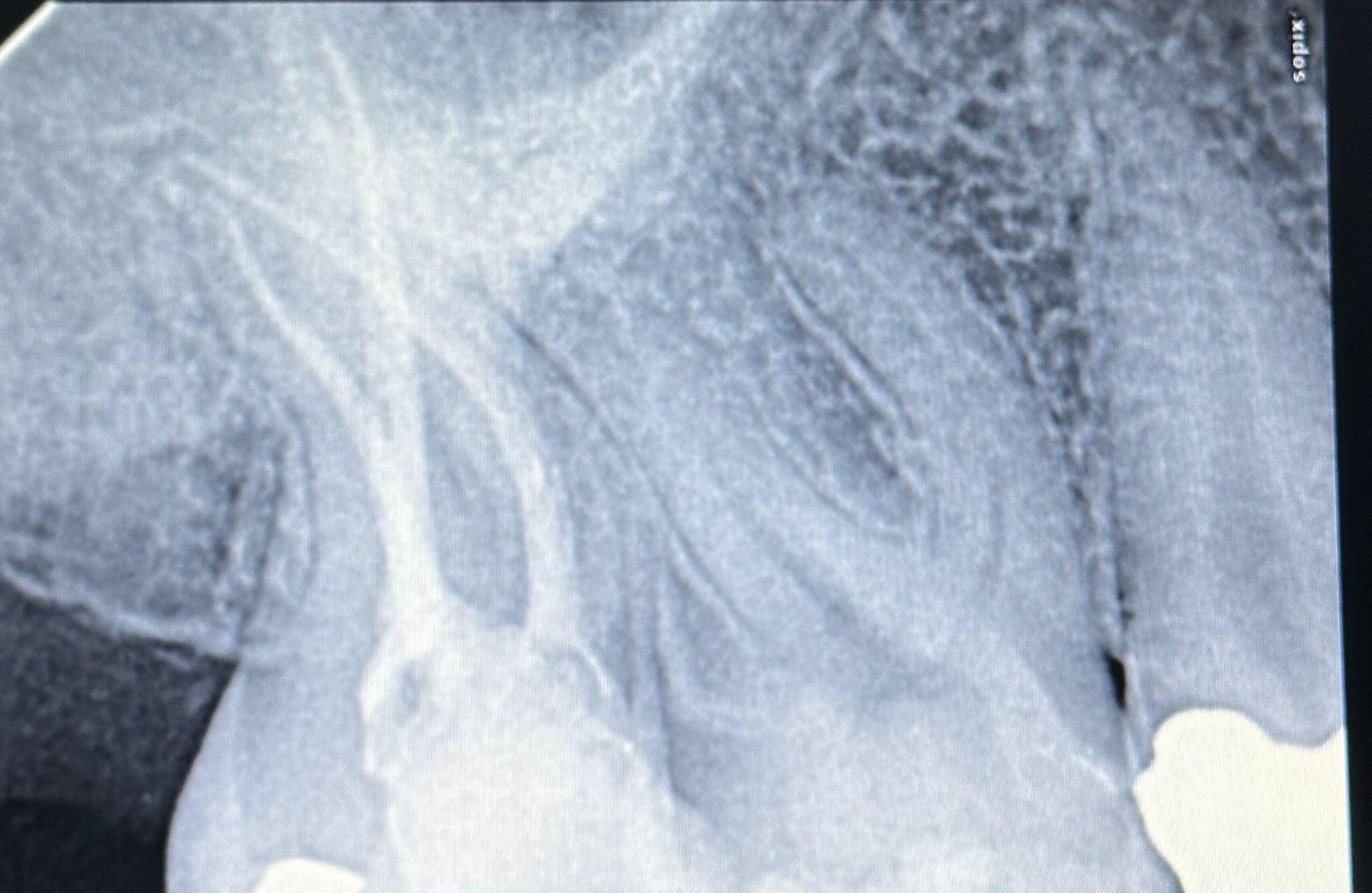 دکتر بیتا فتحی متخصص درمان ریشه