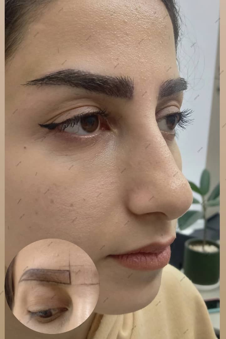 کلینیک زیبایی ورمیس