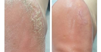 اپیلاسیون vip وندا باخشاب