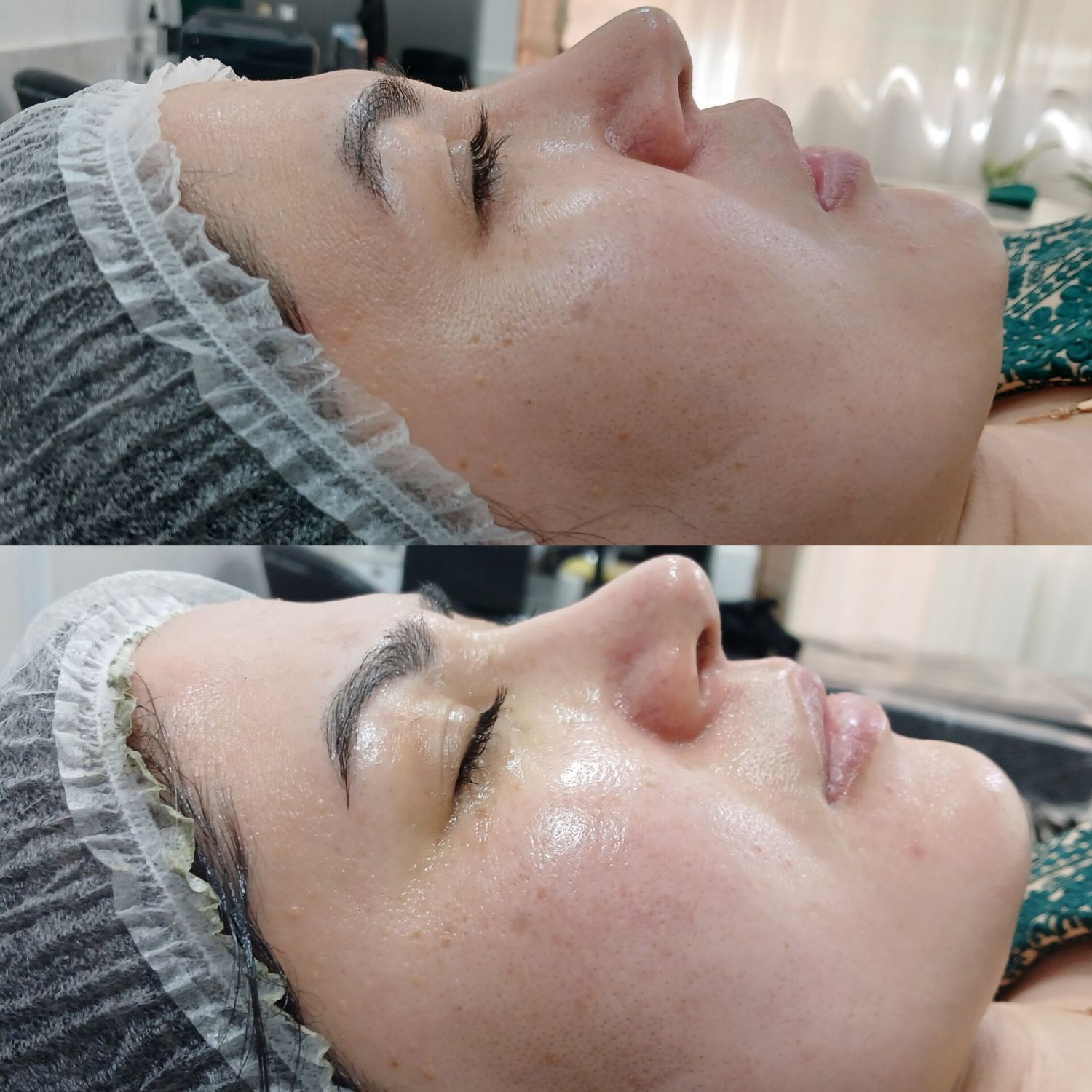 فیشال پاکسازی پوست مرتضوی